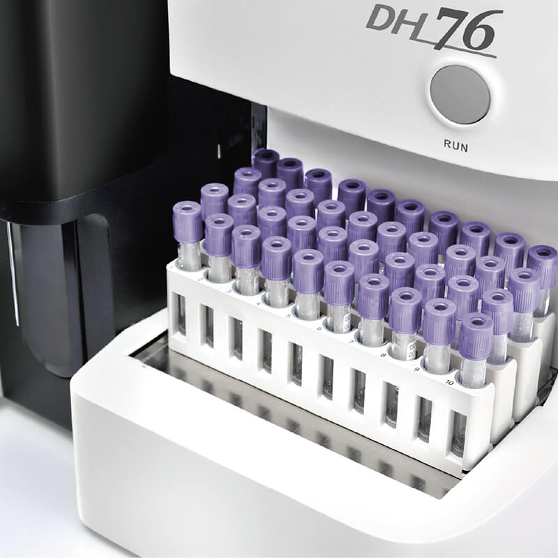 DH76 Analizador Hematológico automático de 5 partes - Imagen 5