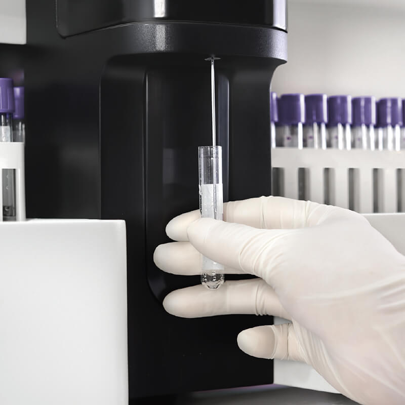 DH76 Analizador Hematológico automático de 5 partes - Imagen 4